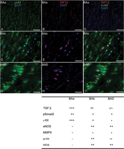 Transverse histological sections of the aortic wall (A–I). Immunofluorescent staining of pc-Kit (green), HIF1α (red) and DAPI (blue). Scale bar: 25 µm.