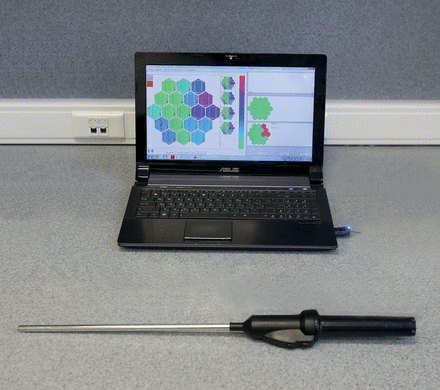 Complex of tactile diagnostics: the tactile mechanoreceptor and the computer.