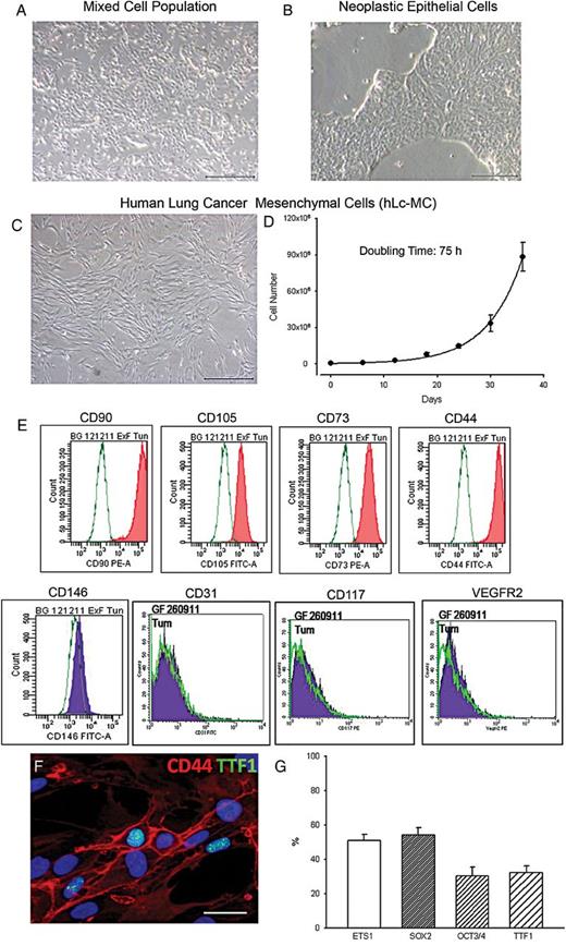 Characterization of human lung cancer mesenchymal cells (hLc-MCs). Phase contrast images of cell cultures documenting a mixed cell population (A) from which tumour epithelial cells (B) and mesenchymal cells (hLc-MCs, (C)) are isolated and expanded from samples of human lung cancer. The growth kinetic curve of hLc-MCs is shown in (D). An example of the immunophenotypic characterization of hLc-MCs by fluorescence-activated cell sorting analysis is illustrated in (E). (F) The nuclear expression of thyroid transcription factor 1 (TTF1) (green) in cultured CD44-positive (red) hLc-MCs is shown by immunofluorescence. Nuclei are recognized by the blue fluorescence of 4′,6-diamidino-2-phenylindole. (G) Bar graph of the quantification of ETS1, sex determining region Y-box 2, octamer-binding transcription factor 3/4 and TTF1 immunolabelling in hLc-MCs. Scale bars: A, B and C = 500 µm; F = 30 µm.
