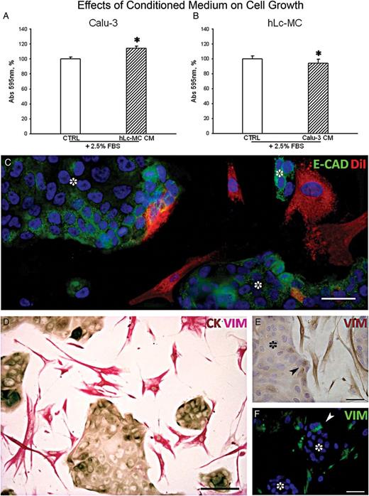 In vitro analysis of the interaction between hLc-MCs and human lung adenocarcinoma. Quantitative estimation of cell growth after short (24 h) exposure of Calu-3 to serum (FBS) supplemented conditioned medium (CM) from hLc-MCs (A) and the reciprocal outcome of CM from Calu-3 cells on hLc-MCs (B). Data are expressed as fraction of crystal violet absorbance at 595 nm (*P < 0.001). (C) Representative image of the typical membrane pattern of E-Cadherin (E-CAD, green) expression in clustering Calu-3 cells (dot) surrounded by DiI prelabelled hLc-MCs (red). (D) Double immunostaining documenting Vimentin (VIM, pinkish) labelled hLc-MCs surrounding CK-positive (brownish) Calu-3 clusters. Vimentin expression in cancer cells (arrowhead) located at the edge of Calu-3 clusters (dot) is shown by both immunoperoxidase in E (VIM, brownish) and immunofluorescence in F (VIM, green). (C and F) Nuclei are recognized by the blue fluorescence of DAPI. Scale bars: C, E and F = 50 µm; D = 100 µm.