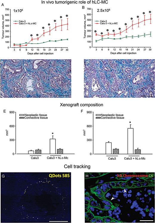 In vivo tumourigenic role of hLc-MCs. Line graphs highlighting the time dependent tumour growth following the injection of Calu-3 cells (green lines) or Calu-3 + hLc-MCs (red lines) at 1 × 106 (A) and 2.5 × 106 (B) cell dosage (*P < 0.05). Masson's trichrome stained sections of tumours generated by two doses of Calu-3 cells are shown in (C and D), respectively, to illustrate the neoplastic glandular epithelium (magenta) surrounded by connective tissue (bluish). Quantification of tissue composition in tumour xenografts as a result of the injection of 1 × 106 (E) and 2.5 × 106 (F) doses of Calu-3 cells alone or Calu-3 + hLc-MCs. *P < 0.001. (G) unstained section of Calu-3 + hLc-MCs derived tumour xenografts excited by ultraviolet light. Yellow fluorescent signals correspond to Quantum Dots (QDots) 585 nm pre-labelled hLc-MCs localized in stromal tissue (blue autofluorescence) surrounding empty black spaces, likely representing neoplastic glandular structures. (H) Fluorenscence in situ hybridization analysis of human X chromosome (red dots) in tumour xenografts generated by the coinjection of Calu-3 cells with hLc-MCs. X chromosome ploidy formation (arrowheads) in CK-positive (green) Calu-3 cells organized in neoplastic glands is apparent. Blue fluorescence corresponds to DAPI staining of nuclei (scale bars C and D = 200 µm; G = 150 µm; H = 40 µm).