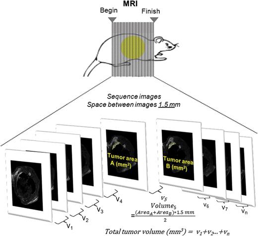 Diagram showing tumour volume quantification from MR images.