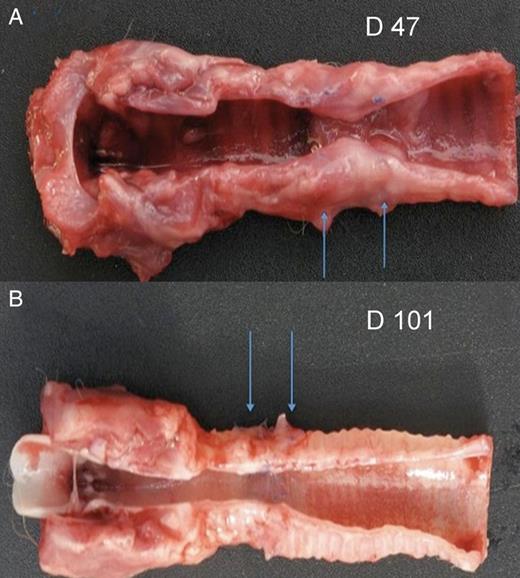 Tracheal transplantation of TA segments after single-stage orthotopic revascularization. (A) Macroscopic aspect on Day 47: longitudinal section of the central airway reveals severe stenosis of the graft (arrows), albeit with a well-epithelialized airway lining (Rabbit 12); and (B) a graft (arrows) well incorporated into the native trachea with satisfying airway patency and well-epithelialized airway lining (Rabbit 13, sacrificed on Day 101).