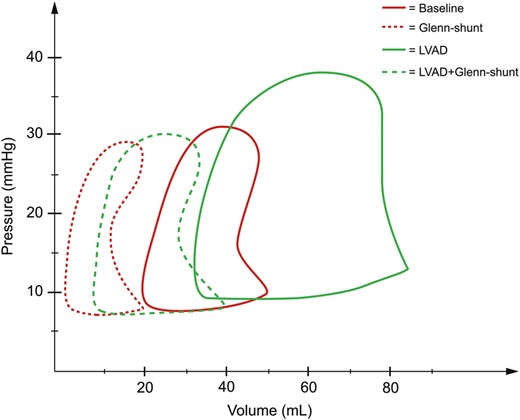 Pressure (mmHg) and volume (ml) loops derived from the right ventricle during the four periods of the study ( n = 8). LVAD: left ventricular assist device; Shunt: modified Glenn shunt.