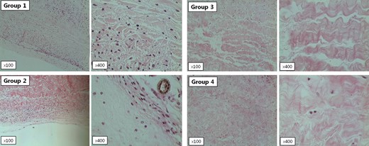 Light microscopic findings (×100 and ×400) of harvested tissue from α-Gal KO mice. All tissues underwent H–E staining. Primate pericardial tissue (Group 1) showed fewer inflammatory cells than bovine pericardial tissue (Group 2), and decellularization and α-galactosidase treatment (Groups 3 and 4) did not significantly increase calcific deposits in the implanted tissue.
