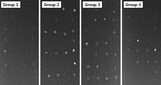 Low-dose X-ray results of tissue implanted into α-Gal KO mice. Groups 2–4 showed more radio-opaque calcifications than Group 1.