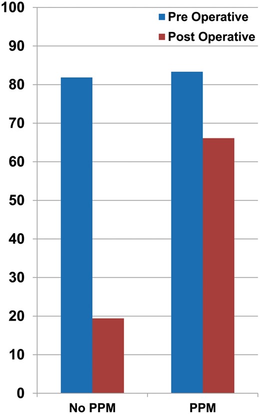Prevalence of PAH (%) before and after MVR in the PPM versus no PPM group. PAH: pulmonary arterial hypertension; MVR: mitral valve replacement; PPM: prosthesis patient mismatch.