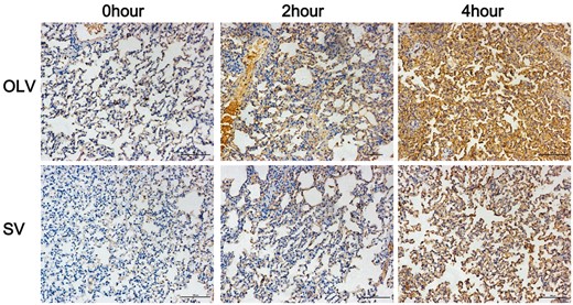 Assessment of TNF-α in lung tissue by immunohistochemical staining. Significantly lower immunostaining was found at 4 h, but not at 0 or 2 h in rabbits from SV group compared with OLV group. Original magnification: ×200. SV: spontaneous ventilation; OLV: one-lung ventilation; TNF-α: tumour necrosis factor α.