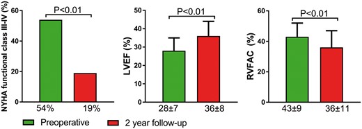 Clinical and echocardiographic characteristics preoperatively and at 2-year follow-up after surgical left ventricular restoration. NYHA: New York Heart Association; LVEF: left ventricular ejection fraction; RVFAC: right ventricular fractional area change.