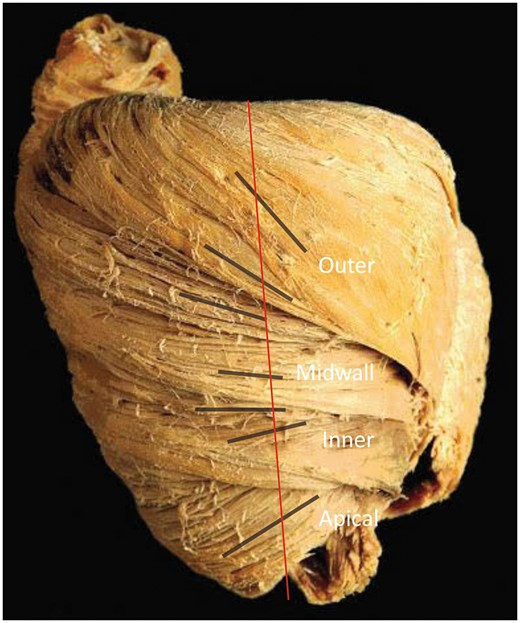 Macroscopic anatomy of the porcine heart. Blunt dissection of the heart shows the gradual transition of the helical angle of the inner, the mid-wall and the outer zones (black lines) compared with the long axis (red line). Figure is provided by P.P. Lunkenheimer and reproduced with permission.
