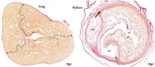 Comparative anatomy. Ventricular architecture in a frog and a snake illustrated by 10-μm-thick transverse sections stained with picrosirius red. The (contracted) ventricle of the Xenopus frog exemplifies the highly trabeculated ventricle found in many fish and amphibians. The arrows show 3 pathways where no myocardium was crossed and by which the extremely thin outer compact layer can be reached from the central lumen. Distinct layers to the compact wall are not recognized in such settings, and even if they are, the functional implications would be proportional to the mass of the layers, i.e. miniscule. The ventricle of pythons has a high-pressure LV and a low-pressure RV surrounded by 2 distinct layers of compact myocardium. (This ventricle was fixed in diastole.) Where the dashed arrow is placed (as in Fig. 2), much of the compact wall is made up of approximately circumferentially oriented myocardium. The presence of this myocardium suggests an old evolutionary origin to the so-called ‘aberrant fibres’ that has to be disrupted initially in the Torrent-Guasp procedure. We propose that ‘aberrant fibres’ is a spurious concept and further propose that the disruption of such commonly found circumferential compact myocardium immediately invalidates the significance of unwinding of the heart. LV: left ventricle; RV: right ventricle.