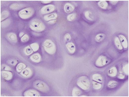 A TUNEL test showed no apoptotic chondrocytes in the de-epithelialized tracheal grafts.