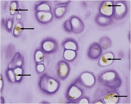 Immunohistochemical staining showed that some matrix metalloproteinase 13-positive chondrocytes (arrows) were scattered in the de-epithelialized tracheal grafts (original magnification ×400).