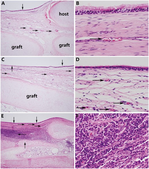 (A) The graft was covered with pseudostratified ciliated columnar epithelium (down arrow), and evident revascularization (right arrow) was observed near the anastomotic sites (the graft was sutured to the host trachea using a telescopic method). (B) Magnification view of regenerative epithelium. (C) The regenerated epithelium gradually transformed from a pseudostratified ciliated columnar epithelium near the anastomotic sites (down arrow) to a monolayer epithelium without cilia in the middle portion of the graft (up arrow). Regenerated small blood vessels (right arrow) were confirmed in the submucosa of the graft. (D) Magnification view of regenerative epithelium. (E) Although the graft was covered with regenerated epithelium (down arrow), the cartilage was partially absorbed and destroyed (up arrow) and accompanied by severe lymphocyte and monocyte infiltration (left arrow). (F) Magnification view. (A, C, and E original magnification ×40; B, D and F original magnification ×400).