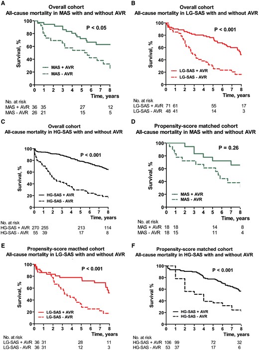 The Kaplan–Meier curve: all-cause mortality for overall cohort (A–C) and for the propensity score-matched cohort (D–F) in MAS (A, D), LG-SAS (B, E) and HG-SAS (C, F) with (solid line) or without (dotted line) AVR. AVR: aortic valve replacement; HG-SAS: high-gradient severe aortic stenosis; LG-SAS: low-gradient severe aortic stenosis; MAS: moderate aortic stenosis.
