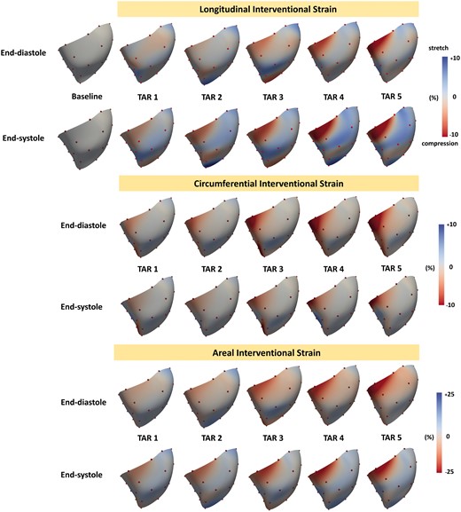 Colour maps of right ventricular (RV) free wall interventional strains during TAR 1–5: longitudinal RV epicardial strain (top panel), circumferential RV epicardial strain (mid-panel) and areal RV epicardial strain (lower panel). Strains are presented at end-diastole and end-systole for each intervention (TAR 1–5) with the reference configuration at Baseline. The positive values (blue colour) indicate the ventricular stretch, whereas the negative values (red colour) indicate the ventricular compression. TAR: tricuspid annular reduction.