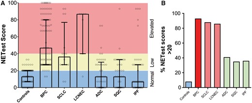NETest scores in controls and in patients with lung neoplasia and benign disease. (A) NETest scores stratified by normal (0–20) (blue), low (21–40) (green) and elevated (>40) (red) levels in each of the cohorts. The Kruskal–Wallis statistic was 154 (P < 0.001). (B) The percentage of positive NETest scores (21–100) in individual cohorts. In lung disease, the percentage of subjects with positive scores ranged from 35% to 93%. Neuroendocrine genotype tumours (red); control subjects (blue); non-small-cell lung cancer. ADC: adenocarcinoma; BPC: bronchopulmonary carcinoids; IPF: idiopathic pulmonary fibrosis (green); LCNEC: large-cell neuroendocrine carcinoma; SCLC: small-cell lung cancer; SQC: squamous cell carcinoma.