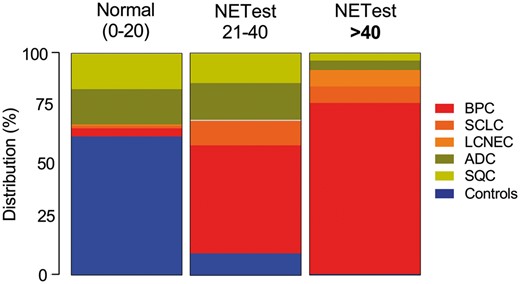 Distribution of NETest scores for controls and individual tumour types. An elevated score (>40) was predominantly identified in BPC and was consistent with a progressive neuroendocrine disease phenotype. ADC: adenocarcinoma; BPC: bronchopulmonary carcinoids; LCNEC: large-cell neuroendocrine carcinoma; SCLC: small-cell lung cancer; SQC: squamous cell carcinoma.