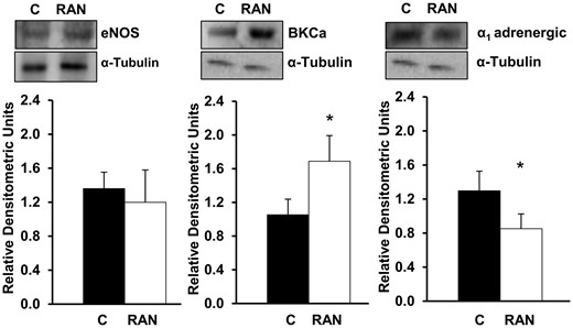 Effects of RAN on eNOS, BKCa channel and ɑ1 adrenergic receptor protein expression. Values are mean ± standard deviation for 4 independent experiments. *P < 0.05. BKCa: large conductance Ca2+-activated K+ channel; C: control; eNOS: endothelial nitric oxide synthase; RAN: ranolazine 10−5 M.