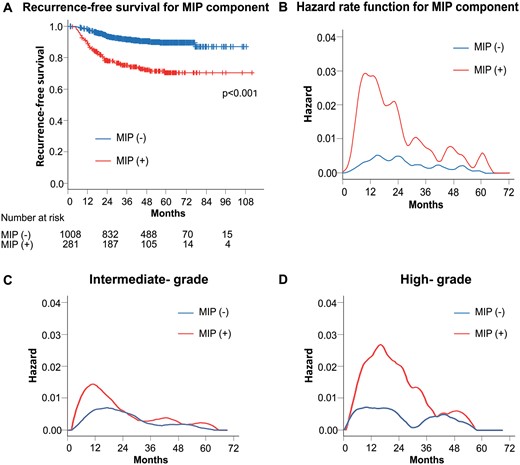 (A) Recurrence-free survival curves according to the presence of MIP component. (B) Smoothed hazard estimates for the presence of MIP component. (C) Smoothed hazard estimates of patients with intermediate-grade tumours according to the presence of an MIP component. (D) Smoothed hazard estimates of patients with high-grade tumours according to the presence of an MIP component. MIP: micropapillary.