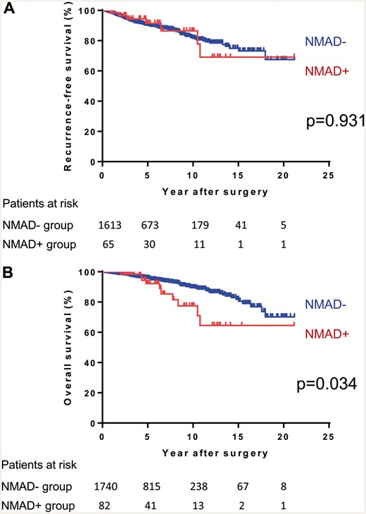 (A) Recurrence-free survival after R0 resection and (B) overall survival curves of thymoma patients with or without NMAD. NMAD: non-myasthenia gravis autoimmune disease.