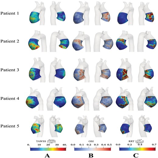 Distribution of (A) time-averaged wall shear stress; (B) oscillating shear index; and (C) relative residence time in the ascending thoracic aortic anerusym patient cohort.