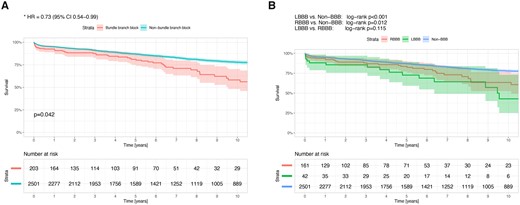 (A) Hazard plot for survival at 10 years with propensity score adjustment, according to the atrioventricular conduction disturbance, in patients who underwent aortic valve replacement. The covariates included in the model were: age, gender, body mass index, diabetes mellitus, hypertension, atrial fibrillation, New York Heart Association functional class, ejection fraction, era of surgery, left ventricle end-diastolic diameter, aortic valve gradients and number of aortic valve leaflets. (B) Ten-year survival curves in patients who underwent aortic valve replacement according to the atrioventricular conduction disturbance. The confidence limits (95%) are presented as a coloured shaded area. HR: hazard ratio; LBBB: left bundle branch block; RBBB: right bundle branch block.