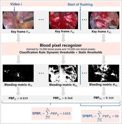 Graphical illustration of the bleeding feature extraction method. PBP: proportion of blood pixels; SPBP: sum of PBP of the entire operation (SumPBP); SPBPF, sum of PBP from flushing to the end of the operation (SumPBP-Flushing).