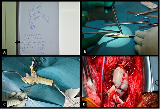 (A) Blueprint of bovine prosthesis. (B) Construction of side branch. (C) Pressurized prosthesis. (D) Implanted prosthesis.