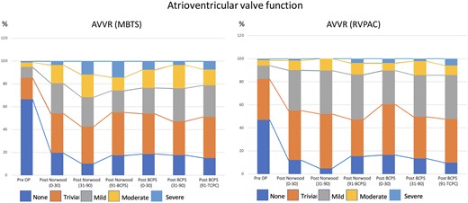 Histograms illustrating the progression of AVVR after the Norwood procedure over time by serial echocardiogram: comparison between MBTS and RVPAC. AVVR: atrioventricular valve regurgitation; BCPS: bidirectional cavopulmonary shunt; MBTS: modified Blalock–Taussig shunt; Pre OP: preoperative; RVPAC: right ventricle to pulmonary artery conduit; TCPC: total cavopulmonary connection.
