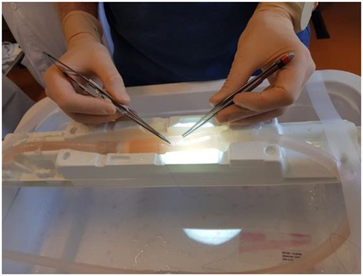 Resident using a 3D vessel model for simulated cannulation.