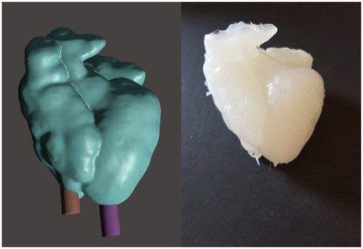 Left: 3D model of the heart created by Meshmixer software, with 2 supports maintaining the wax cast of the chambers in place. Right: silicone model of the heart exhibiting a Taussig-Bing double-outlet right ventricle.
