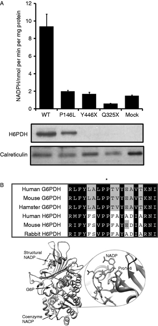 Molecular analysis of novel H6PD mutations. (A) H6PDH enzyme activity assays in HEK293 cells mock transfected or stably transfected with the WT and mutant cDNA constructs expressed as nmol NADPH/min per mg microsomal protein (mean±s.e.m.; n=3). Western blot analysis of microsomal proteins from HEK293-transfected cells. H6PDH protein is clearly visible in cells expressing both WT and P146L. No signal is visible for p.Y446X or p.Q325X as the peptide sequence used to raise the H6PDH antibody would be missing in these truncated proteins. Anti-calreticulin antibody was used as a loading control. (B) Protein alignments across species of both H6PDH and the related enzyme, glucose-6-phosphate dehydrogenase (G6PDH), indicating significant sequence conservation of the proline (P146L) residue (marked with *). Ribbon representation of the crystal structure of G6PDH (composite of two structures; PDB codes: 2BH9, 2BHL – chain A only). The glucose-6-phosphate substrate (G6P, red) and coenzyme NADP (orange) bind at adjacent sites. Another ‘structural’ NADP (pink) binds some distance away. Right-hand panel is a close-up of the coenzyme NADP+ binding region showing the proximity of the key proline residues (highlighted in green) to the bound coenzyme. Structural images produced using UCSF Chimera from the Resource for Biocomputing, Visualization, and Informatics at the University of California, San Francisco (http://www.cgl.ucsf.edu/chimera, supported by NIH P41 RR-01081) (19). Full colour version of this figure available via http://dx.doi.org/10.1530/EJE-12-0628.