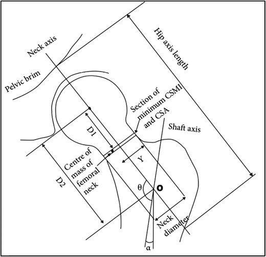 Diagram showing how geometric parameters were measured from 2D dual-energy X-ray absorptiometry (DXA) images in advanced hip analysis (AHA). Adapted from Ark et al.24