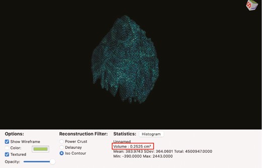 Completed 3D rendering of the dental follicle of the impacted maxillary canine with the associated volumetric calculation. The photo shows that the dental follicle has a 0.2525 cm3 or 252.5 mm3 volume.