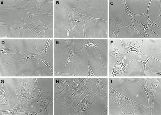 Phase-contrast micrographs of human thyroid (panels A–C), orbital (panels D–F), and dermal (panels G–I) fibroblasts in primary culture. Cells were subpassaged on glass coverslips and allowed to attach in medium supplemented with 10% FBS. They were then shifted to medium containing 1% FBS for 6 h (panels A, D, and G) supplemented with PGE2 (100 nm, panels B, E, and H) or 8-br-cAMP (1 mm, panels C, F, and I).