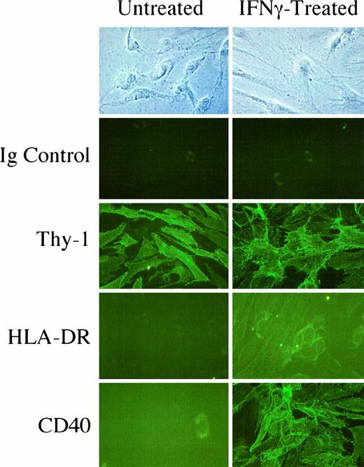 In situ staining of primary thyroid fibroblasts for the surface expression of Thy-1, HLA-DR, and CD40. Monolayers were incubated without or with interferon-γ (500 U/ml) for 72 h and then stained with anti-Thy-1 (F15–421-5), antihuman HLA-DR, anti-CD40, or Ig isotype antibody (as a control). Cultures were then incubated with FITC-conjugated secondary goat antimouse antibody. Final magnification, ×132.