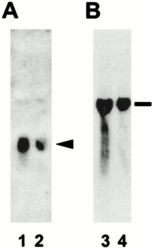 Specificity of S100A1 and S100B PCR-labeled probes. The resulting autoradiographs obtained after incubation of duplicate Northern blots in 32P-labeled S100A1 (panel A) or S100B (panel B) probes are shown. Lanes 1 and 3 contain total RNA isolated from control brain tissue, and lanes 2 and 4 contain total RNA isolated from diabetic brain tissue. The arrowhead denotes the 500-bp S100A1 mRNA and the line indicates the 1500-bp S100B mRNA.
