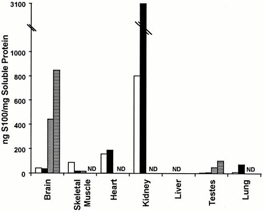 S100A1 and S100B protein levels in various tissues from normal and type I diabetic rats. S100A1 and S100B protein levels were determined by RIA as described in Materials and Methods. The data are expressed as the mean nanograms of S100/mg soluble protein ± the se of two determinations. The open and black bars represent S100A1 protein levels in normal and type I diabetic tissues, respectively. The dotted and horizontally hatched bars represent S100B levels in control and type I diabetic tissues, respectively. ND denotes no detectable protein.