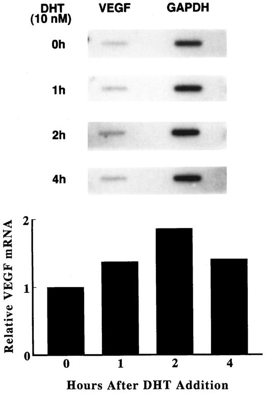 Transcriptional regulation of VEGF production. Primary cultures of human fetal prostatic fibroblasts were cultured with 10 nm DHT for various times at 37 C. Transcription was then determined by nuclear run-on assay, as described under Materials and Methods. The data were quantified using a densitometer, and the densities are normalized to GAPDH levels. The results are reported as the percentage increase in VEGF mRNA, relative to the control level in untreated cells.