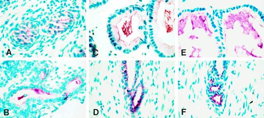 Immunohistochemical localization of TGFα in paraformaldehyde-fixed rat ventral prostate during postnatal development at different ages: day 5 (A), day 10 (B), day 20 (C, distal segment; D, proximal segment), and day 45 (E, distal segment; F, proximal segment). Red color indicates TGFα staining, and blue stain indicates nuclear staining using methyl green.