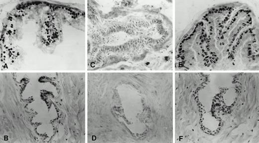 Immunohistochemical localization of androgen receptor in frozen sections of ventral prostate of adult intact (90-day-old), castrate, and castrate plus testosterone-replaced rats. A and B, Distal and proximal segments, respectively, of intact rat. C and D, Distal and proximal segments, respectively, 7 days after castration. E and F, Distal and proximal segments, respectively, after castration for 7 days followed by testosterone replacement (2.5-cm testosterone-filled capsule) for an additional 7 days.