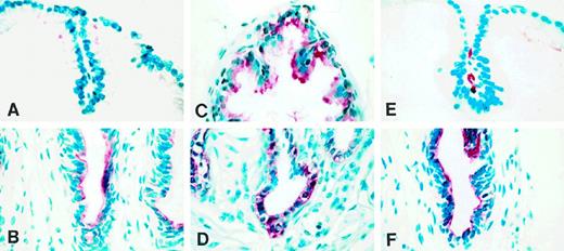 Immunohistochemical localization of TGFα in paraformaldehyde-fixed ventral prostate of adult intact (90-day-old), castrate, and castrate plus testosterone-replaced rats. A and B, Distal and proximal segments, respectively, of intact rat. C and D, Distal and proximal segments, respectively, 7 days after castration. E and F, Distal and proximal segments, respectively, after castration for 7 days followed by testosterone replacement (2.5-cm testosterone-filled capsule) for an additional 7 days.