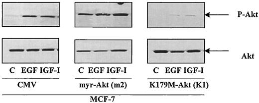 Characterization of MCF-7 cells stably transfected with constitutively active and dominant negative Akt. MCF-7 cells were stably transfected with the expression vector alone, the constitutively active mutant, myr-Akt, or the dominant negative mutant, K179M-Akt, as described in Materials and Methods. Clones were selected, serum-starved, and treated with either EGF or IGF-I. Western blot analysis was performed using an anti phospho-Akt (S473) antibody. One representative clone from each transfection is shown. The m2 clone contains the constitutively active Akt mutant, whereas the K1 clone expresses the dominant negative Akt mutant. Experiments were repeated twice for each clone, as well as for pooled clones.