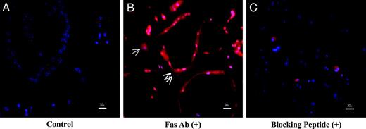 Immunohistochemistry of Fas in osteoclasts. Differentiated mouse osteoclasts were stained with Fas antibody and subsequently with Alexa546 fluorescent-conjugated antirabbit IgG. A, Control, without Fas antibody. B, Stained with Fas antibody. The red color represents specific Fas staining. Single arrow, mononuclear cells; double arrows, multinuclear cells. C, Stained with Fas antibody in the presence of blocking peptide (20 μg/ml). Scale bar, 30 μm.