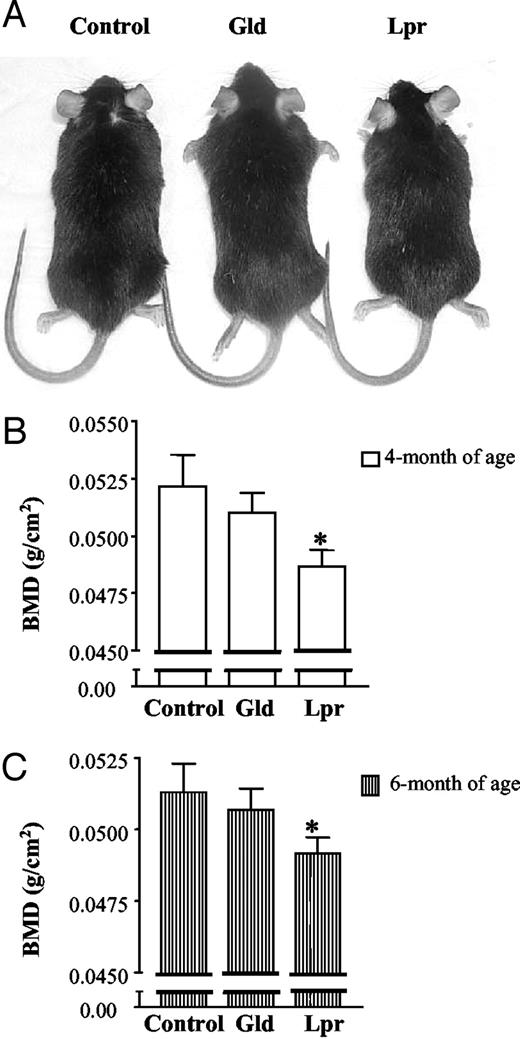 BMD change in Lpr and Gld mice. A, Sizes of control, Gld, and Lpr mice at 6 months of age. B, BMD at 4 months of age. At 4 months of age, four control mice and five Lpr and Gld mice were placed on a PIXImus densitometer, and whole body BMD was measured. C, BMD at 6 months of age for the same groups of mice. Results are presented as mean ± sem. *, P < 0.05 vs. control.