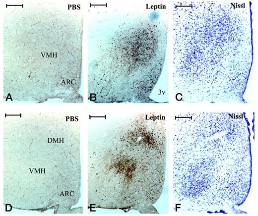 Leptin rapidly stimulates STAT3 phosphorylation in the mediobasal hypothalamus. Rats were given a single ip injection of recombinant leptin (1.0 mg/kg; B and E) or vehicle (PBS; A and D) and killed 45 min later. Coronal brain sections were obtained and subjected to IHC using anti-pY-STAT3 antiserum (A, B, D, and E) or to Nissl staining (C and F) as described in Materials and Methods. Shown are microphotographs of two matched series of sections from the hypothalamus (A–C, bregma −2.30) and (D–F, bregma −3.30). 3v, Third ventricle. Scale bars, 200 μm.
