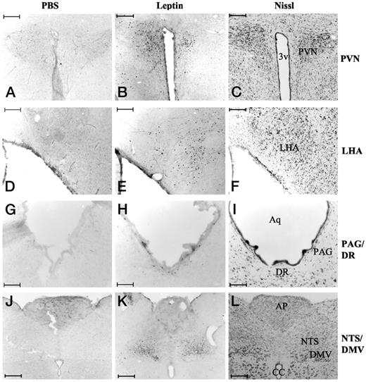 Activation of STAT3 phosphorylation by leptin in hypothalamic and extrahypothalamic brain regions of the rat. Animals were treated, and brain sections were obtained as described for Fig. 4. Shown are microphotographs of four matched series of sections from the PVN (A–C), LHA (D–F), PAG (G–I), and NTS (J–L). DMV, Dorsal motor nucleus of the vagus; 3v, third ventricle; CC, central canal; AP, area postrema; Aq, aquaduct. Nissl staining is shown of corresponding sections and fields to each brain region (C, F, I, and L). Scale bars, A–F and J–L, 200 μm; G–I, 100 μm.