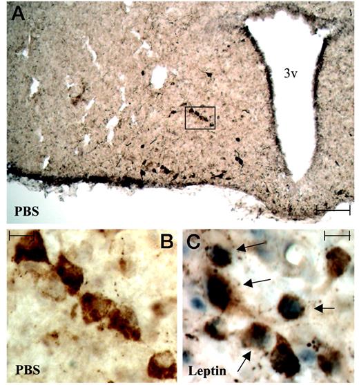 Activation of STAT3 phosphorylation by leptin in POMC neurons. Rats were given a single ip injection of recombinant leptin (1.0 mg/kg; C) or PBS (A and B) and killed 45 min later. Coronal brain sections were subjected to double IHC using anti-α-MSH (brown staining) and anti-pY-STAT3 (blue staining) antiserum as described in Materials and Methods. Shown are examples of microphotographs of fields from sections of the basal hypothalamus of a PBS-treated rat (A, low magnification; B, high magnification of area indicated in A) and a leptin-treated rat (C, high magnification). 3v, Third ventricle. Arrows indicate double-labeled cells. Scale bars, A, 100 μm; B and C, 10 μm.