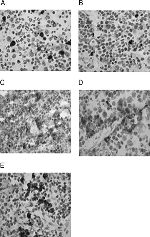 Immunohistochemical staining with syndecan-1 (CD138) for plasma cells in spleen sections of treated animals. BAFFR-Fc (A), BCMA-Fc (B), PBS (C), natural history (D), and β-Gal (E). Dark shade indicates positive staining; magnification, ×60.